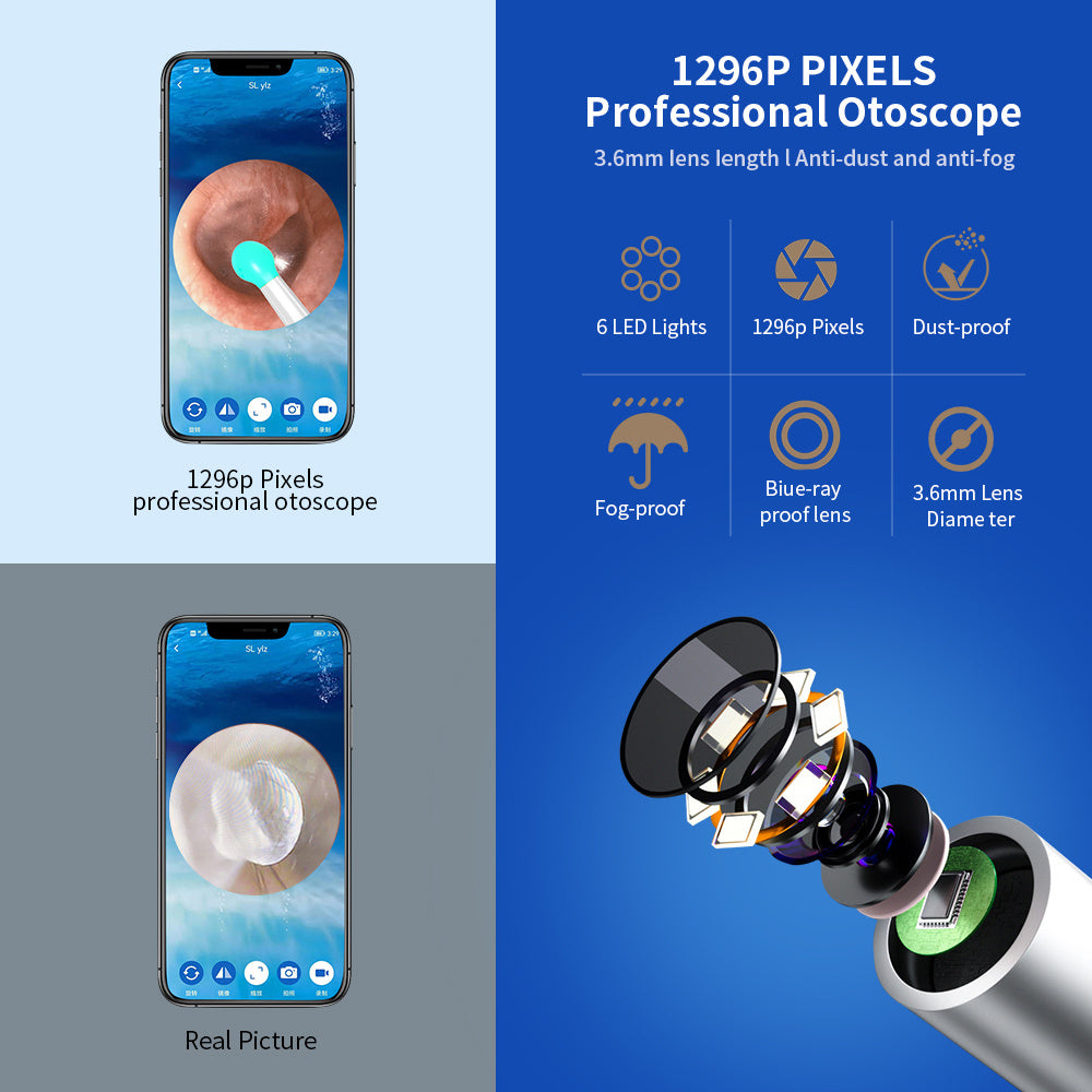 Ear Cleaner Otoscope with HD Camera & LED Light