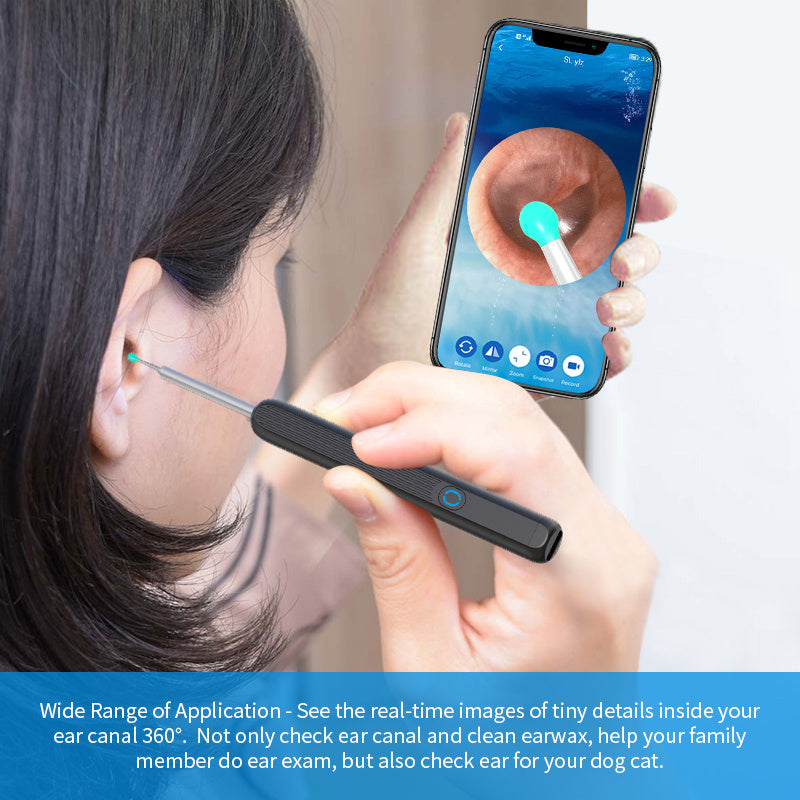 Ear Cleaner Otoscope with HD Camera & LED Light