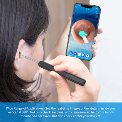 Ear Cleaner Otoscope with HD Camera & LED Light